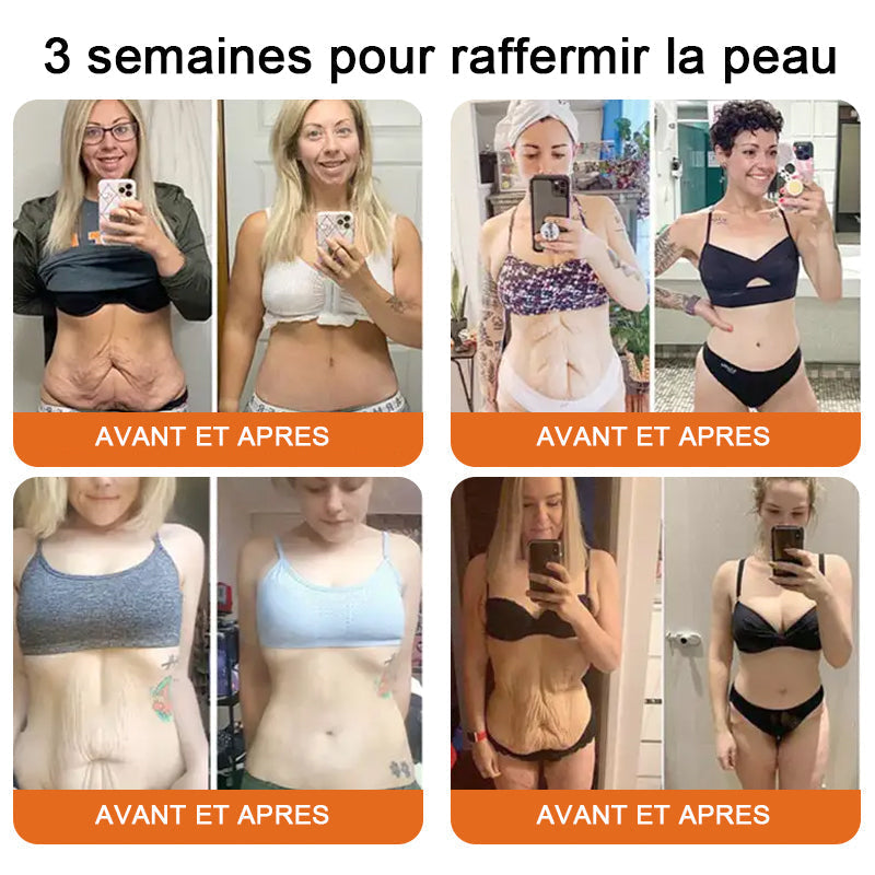 "Fabriqué et expédié de France|✅ Boutique officielle✨Purelora® venin d'abeille Crème réparatrice au 🔥 DERNIER JOUR - 80 % DE RÉDUCTION 💎"