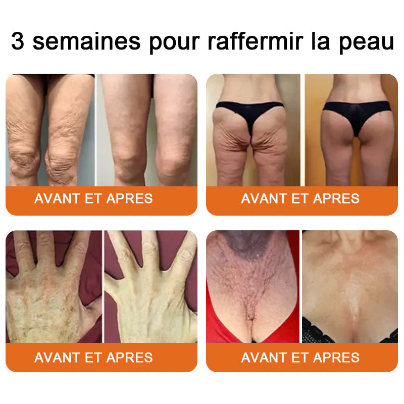 "Fabriqué et expédié de France|✅ Boutique officielle✨Purelora® venin d'abeille Crème réparatrice au 🔥 DERNIER JOUR - 80 % DE RÉDUCTION 💎"