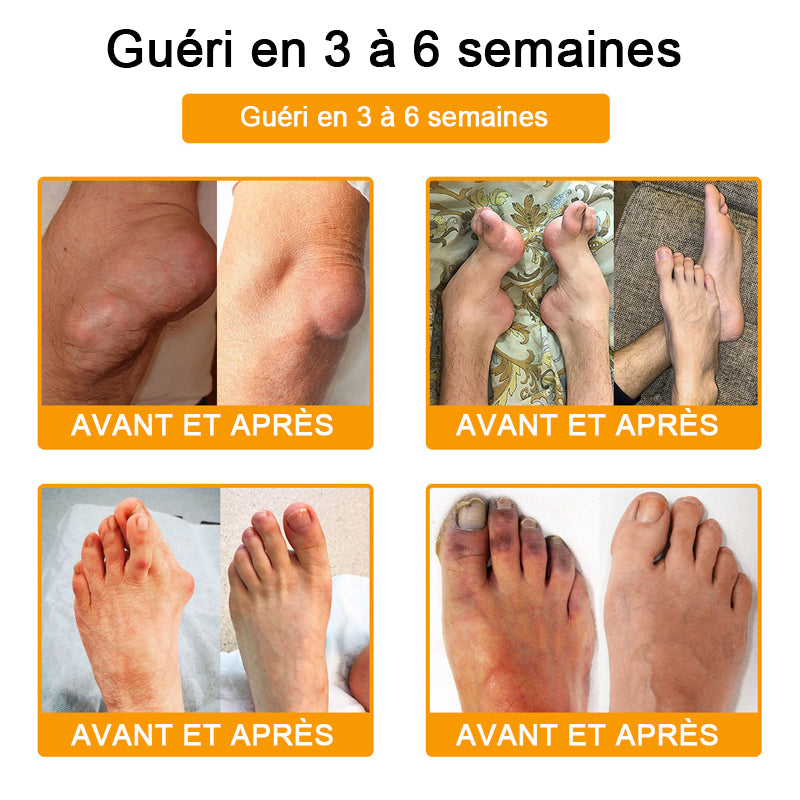 Purelora® Crème Apitoxine pour Soulager les Douleurs Articulaires et Réparer – Cicatrisation Profonde de l'Os et Soulagement Instantané de la Douleur (Formule Officielle Britannique)