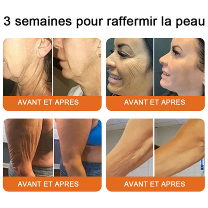 "Fabriqué et expédié de France|✅ Boutique officielle✨Purelora® venin d'abeille Crème réparatrice au 🔥 DERNIER JOUR - 80 % DE RÉDUCTION 💎"