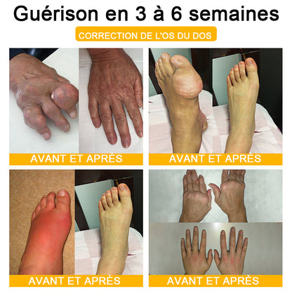 Purelora® Crème Apitoxine pour Soulager les Douleurs Articulaires et Réparer – Cicatrisation Profonde de l'Os et Soulagement Instantané de la Douleur (Formule Officielle Britannique)