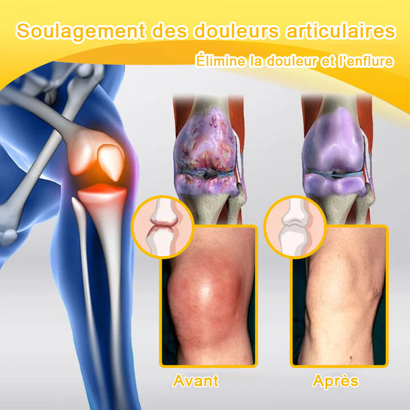 Purelora® Crème Apitoxine pour Soulager les Douleurs Articulaires et Réparer – Cicatrisation Profonde de l'Os et Soulagement Instantané de la Douleur (Formule Officielle Britannique)