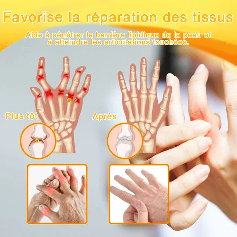 Purelora® Crème Apitoxine pour Soulager les Douleurs Articulaires et Réparer – Cicatrisation Profonde de l'Os et Soulagement Instantané de la Douleur (Formule Officielle Britannique)