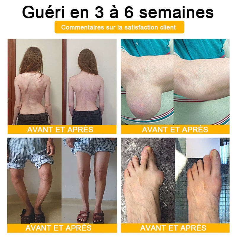 Purelora® Crème Apitoxine pour Soulager les Douleurs Articulaires et Réparer – Cicatrisation Profonde de l'Os et Soulagement Instantané de la Douleur (Formule Officielle Britannique)