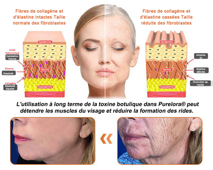 "Fabriqué et expédié de France|✅ Boutique officielle✨Purelora® venin d'abeille Crème réparatrice au 🔥 DERNIER JOUR - 80 % DE RÉDUCTION 💎"