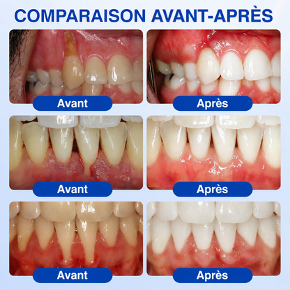 💎𝑷𝒖𝒓𝒆𝒍𝒐𝒓𝒂® 𝑮𝒖𝒎𝑹𝒆𝒗𝒊𝒗𝒆 𝑮𝒆𝒍 𝒅𝒆 𝑹é𝒑𝒂𝒓𝒂𝒕𝒊𝒐𝒏 𝑷𝒂𝒓𝒐𝒅𝒐𝒏𝒕𝒂𝒍𝒆