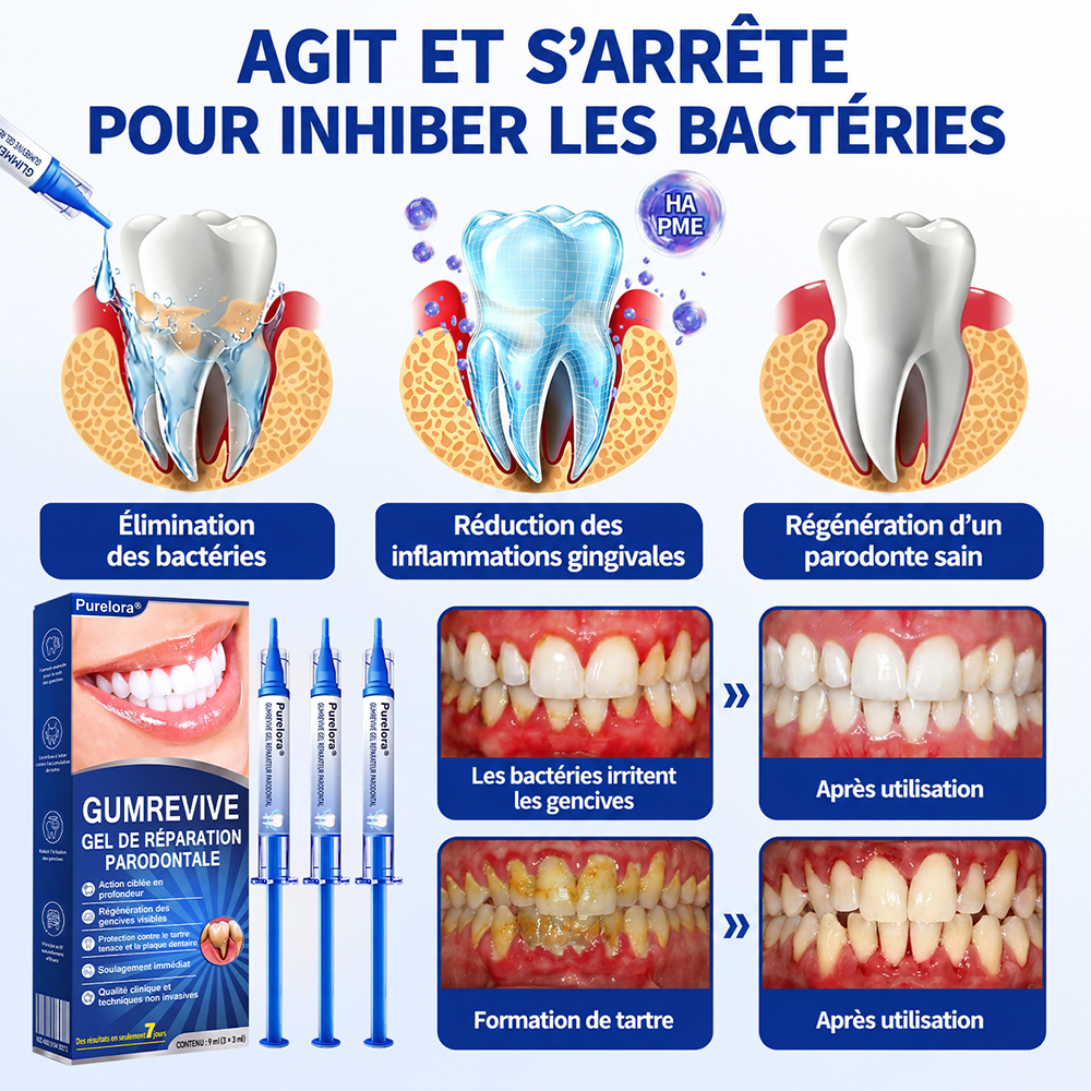 💎𝑷𝒖𝒓𝒆𝒍𝒐𝒓𝒂® 𝑮𝒖𝒎𝑹𝒆𝒗𝒊𝒗𝒆 𝑮𝒆𝒍 𝒅𝒆 𝑹é𝒑𝒂𝒓𝒂𝒕𝒊𝒐𝒏 𝑷𝒂𝒓𝒐𝒅𝒐𝒏𝒕𝒂𝒍𝒆