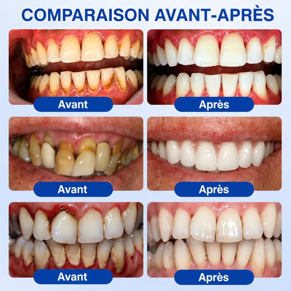 Purelora® 🧑‍⚕️ GumRevive Gel Réparateur Parodontal 🧸