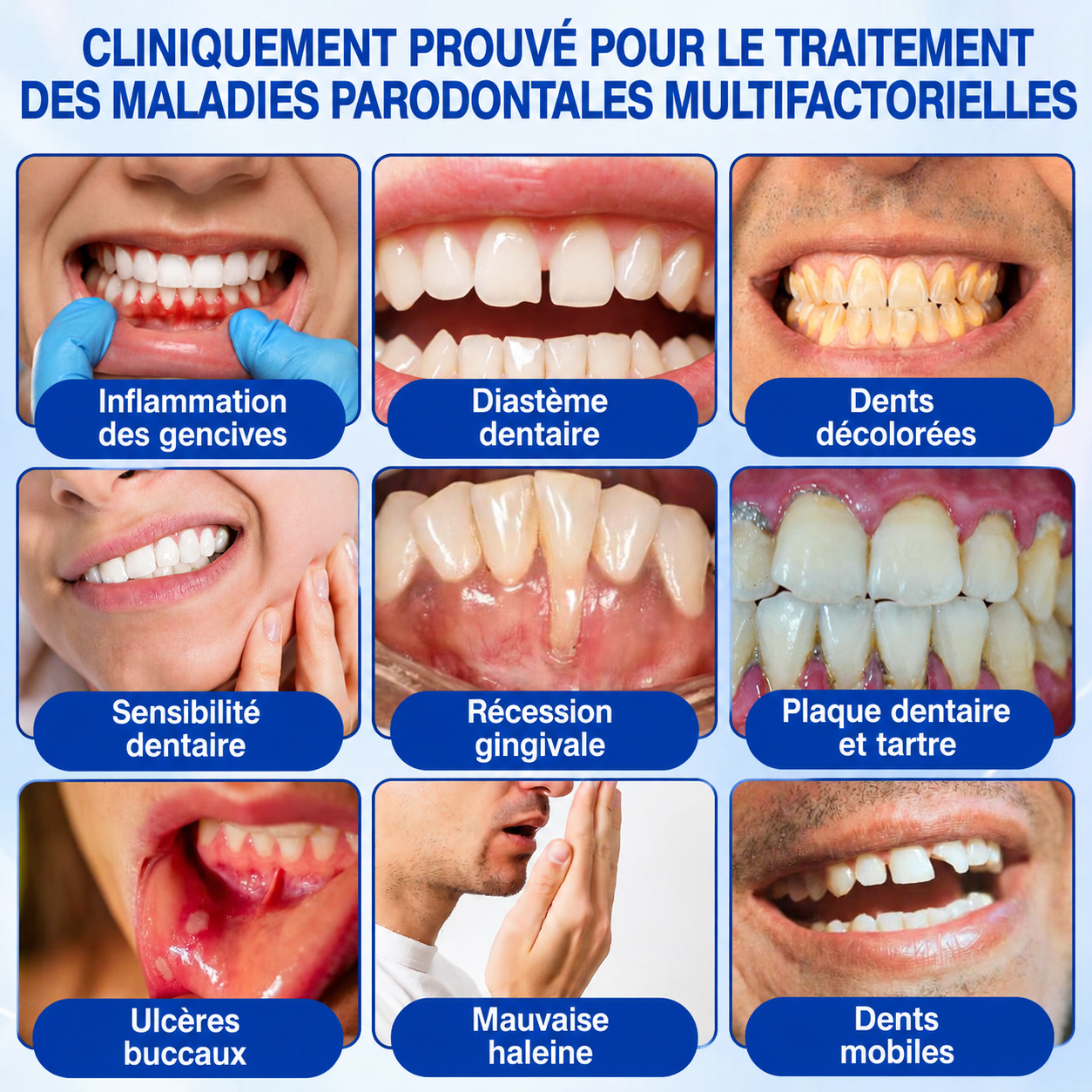 💎𝑷𝒖𝒓𝒆𝒍𝒐𝒓𝒂® 𝑮𝒖𝒎𝑹𝒆𝒗𝒊𝒗𝒆 𝑮𝒆𝒍 𝒅𝒆 𝑹é𝒑𝒂𝒓𝒂𝒕𝒊𝒐𝒏 𝑷𝒂𝒓𝒐𝒅𝒐𝒏𝒕𝒂𝒍𝒆