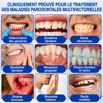 Purelora® 🧑‍⚕️ GumRevive Gel Réparateur Parodontal 🧸