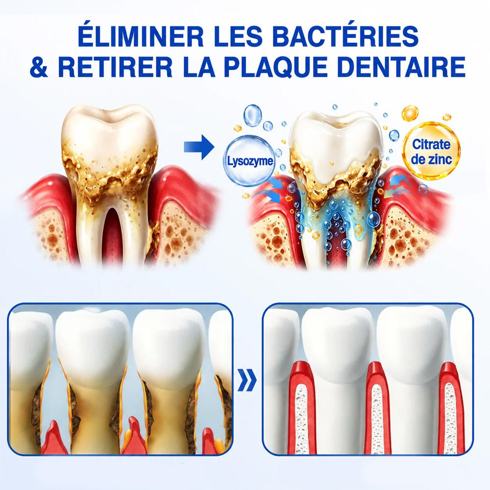 Purelora® 🧑‍⚕️ GumRevive Gel Réparateur Parodontal 🧸